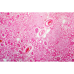 TINCIÓN PARA MICROSCOPÍA - EOSINA