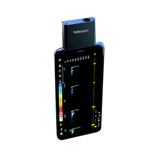 PETTERSSON U384 MICRÓFONO DE ULTRASONIDOS CON CONEXIÓN USB